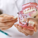 Dentist holding a dental implant and bridge model to compare tooth replacement options
